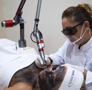 QスイッチNd Yagレーザーシステム